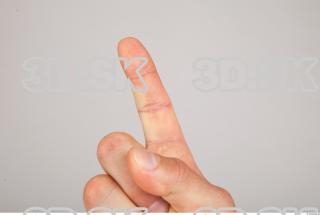 Finger texture of Gene 0002